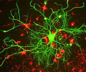 Neuron image by Gerry Shaw