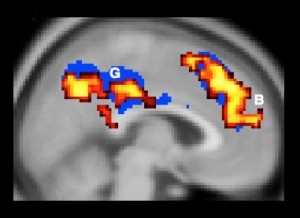 fMRI brain scan by Cushman Lab Brown University