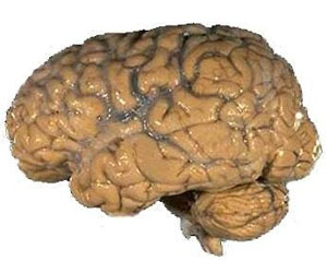 Human brain