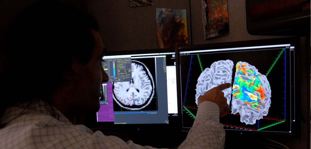 ‘Brain road maps’ reflect behavior differences between men and women