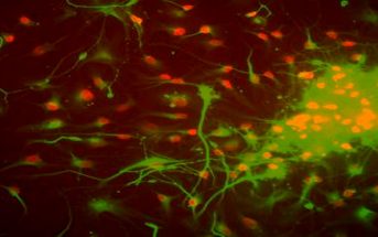 Prenatal Infection May Alter Behavior >> Postpartum depression and anxiety distinct from other mood ... Prenatal Infection May Alter Behavior >> Postpartum depression and anxiety distinct from other mood ...
