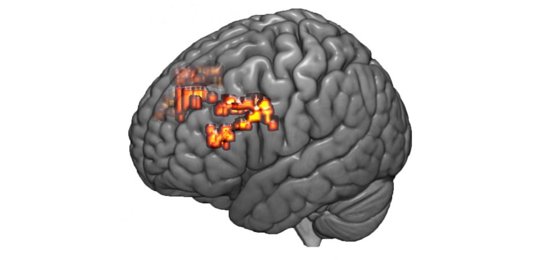 Neurological development meaning image 5