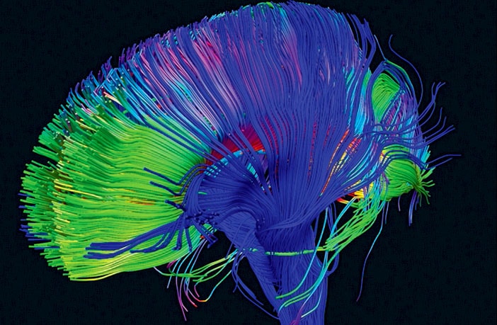 lsd produces a new type of harmonic order in the brain according blue order