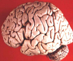 Human brain photo by John A Beal