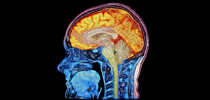 Photo credit: Wellcome Images (Creative Commons)