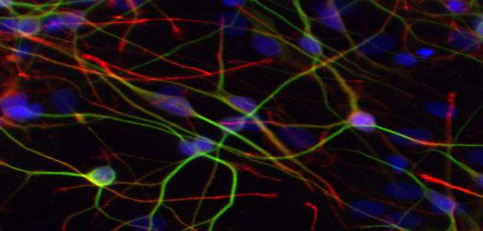 Study Pinpoints Autism Linked Protein >> Researchers Pinpoint Chemo Effect On Brain Cells Potential Link To Study Pinpoints Autism Linked Protein >> Researchers Pinpoint Chemo Effect On Brain Cells Potential Link To