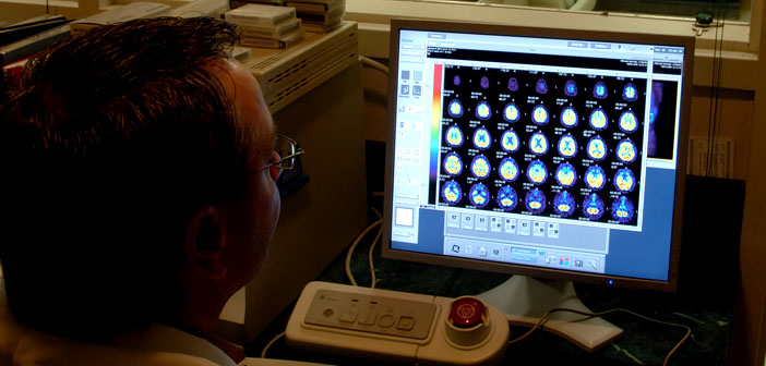 Autistic Features Linked To Prenatal >> Autistic Features Linked To Prenatal Exposure To Fire Retardants Autistic Features Linked To Prenatal >> Autistic Features Linked To Prenatal Exposure To Fire Retardants