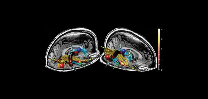 Photo credit: Radiological Society of North America