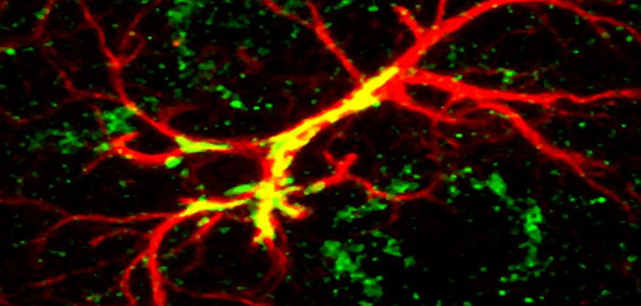 Study Pinpoints Autism Linked Protein >> Study Pinpoints Autism Linked Protein For Sculpting Brain Study Pinpoints Autism Linked Protein >> Study Pinpoints Autism Linked Protein For Sculpting Brain