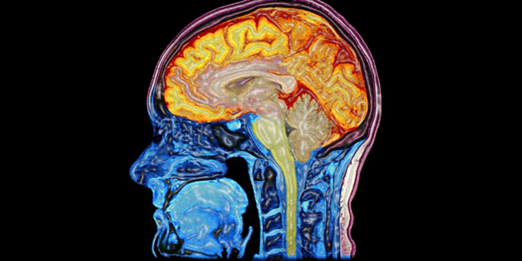 Photo credit: Wellcome Images