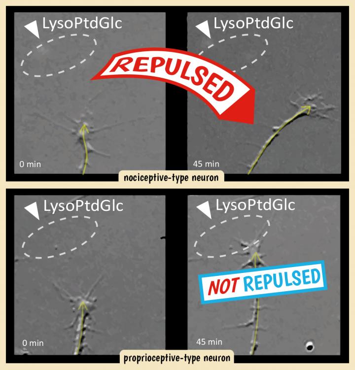 After 45 minutes, a nociceptive (pain-sensing) neuron has been guided to the right after being repelled away from the LysoPtdGlc gradient (top). In contrast, a proprioceptive (position-sensing) neuron continues on a straight course (bottom).