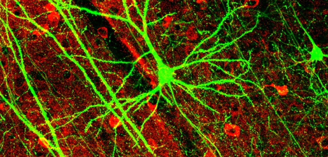 how many neurons in the brain how many neurons in the brain