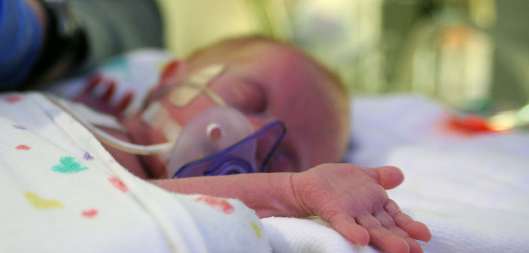 Mris Predict Which High Risk Babies >> Risk Of Cognitive Impairment In Children Born Prematurely May Be Mris Predict Which High Risk Babies >> Risk Of Cognitive Impairment In Children Born Prematurely May Be