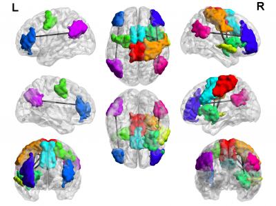 A new study led by the University of Utah School of Medicine and Chung-Ang University provides evidence that several regions of the brain are hyperconnected in adolescent boys diagnosed with Internet gaming disorder (lines between colored areas, colored areas represent specific brain networks). Some of the changes may help game players respond to new information, others are associated with distractibility and poor impulse control. (Credit: Jeffrey Anderson)