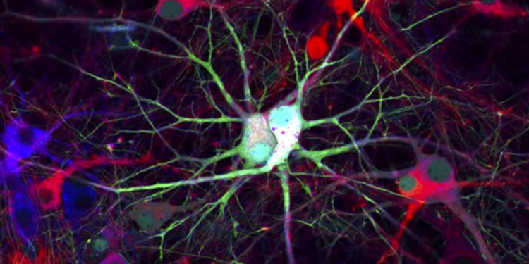 (Photo credit: Wellcome Images)