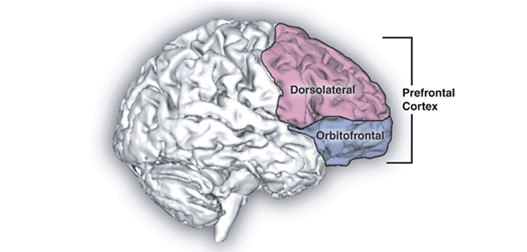 Accelerated orbitofrontal cortex thinning may serve as a link between childhood adversity and adult depression