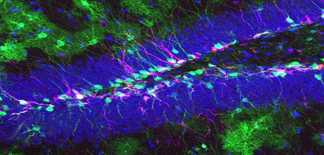 (Credit: University of Basel)