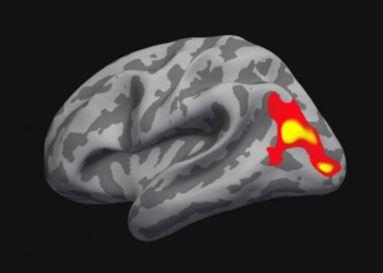 In the marked brain region the thickness of the cerebral cortex decreased after psychotherapy. (Photo credit: UZH)