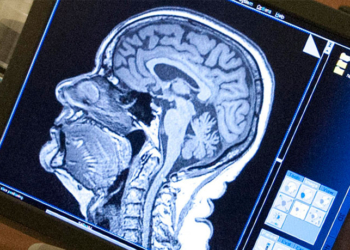 An MRI scan of a research subject's brain is displayed on a computer (Photo credit: Penn State)