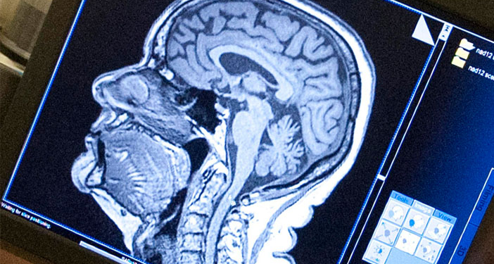 An MRI scan of a research subject's brain is displayed on a computer (Photo credit: Penn State)