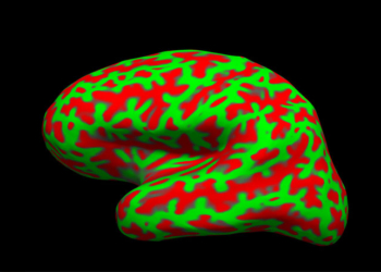Brain MRI image. The green represents the flattened ridges (gyri) of my brain and the red depicts the unfolded furrows (sulci). (Photo credit: Reigh LeBlanc)