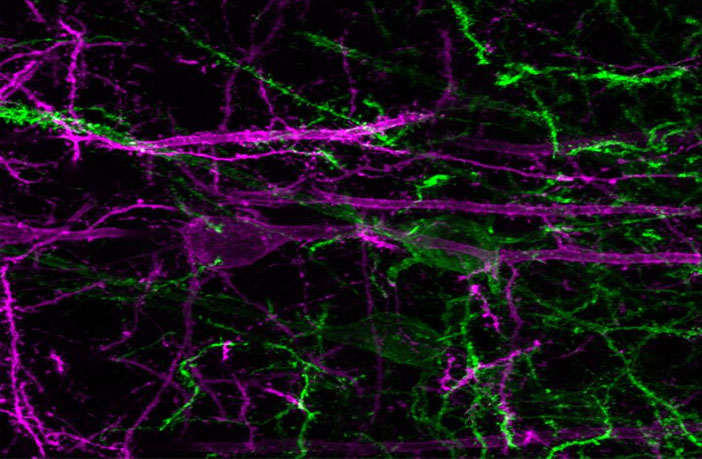 Green: NAc-projecting prefrontal cortex neurons become active during the presentation of a reward-predictive cue, and this activity drives reward-seeking behavior. Purple: PVT-projecting prefrontal cortex neurons inhibited during reward-predictive cue. (Photo credit: The Stuber Lab)