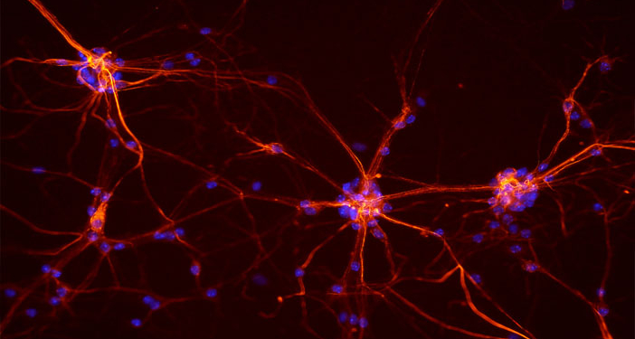 Neurons from a mouse spinal cord. (Photo credit: NICHD/S. Jeong)