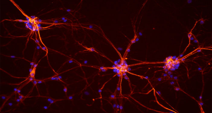 Neurons from a mouse spinal cord. (Photo credit: NICHD/S. Jeong)