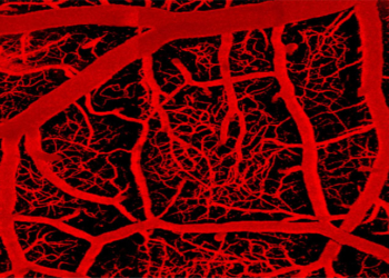 The brain's vascular network, shown in this image, consists of arteries, which penetrate into the brain to feed a vast capillary network, which is then drained by veins. (Photo credit:  Thomas Longden)