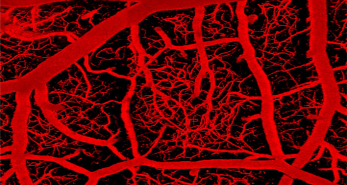 The brain's vascular network, shown in this image, consists of arteries, which penetrate into the brain to feed a vast capillary network, which is then drained by veins. (Photo credit:  Thomas Longden)