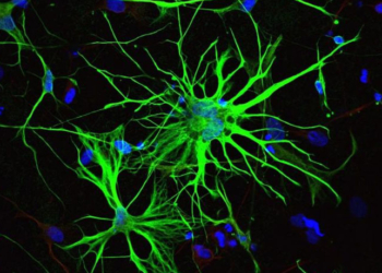 To manipulate the astrocytes in the SCN independently of neurons, the scientists needed a way to target the astrocytes alone. The key turned out to a structural protein that helps to give astrocytes their branching structure, here linked to a protein that fluoresces green. (Photo credit: LPDWiki)