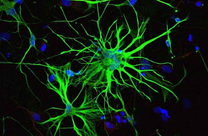 To manipulate the astrocytes in the SCN independently of neurons, the scientists needed a way to target the astrocytes alone. The key turned out to a structural protein that helps to give astrocytes their branching structure, here linked to a protein that fluoresces green. (Photo credit: LPDWiki)