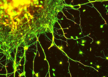 Neurons (Photo credit: MR McGill)