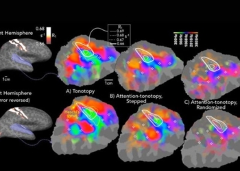 This image shows auditory cortical maps of sound frequency and attention. (Photo credit: Carnegie Mellon University)