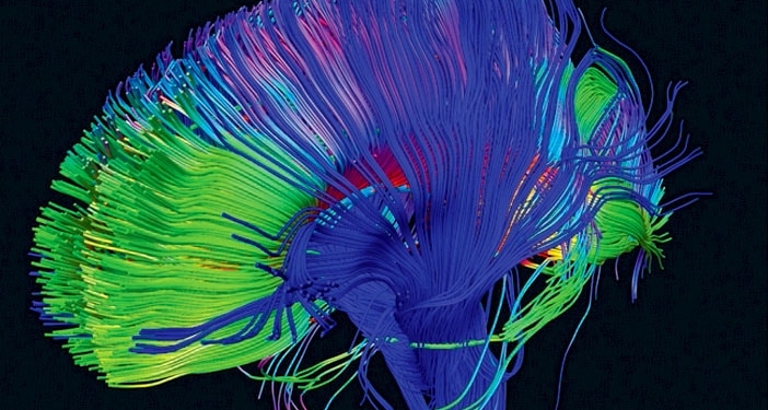 Here, the brain's neural pathways have been reconstructed using tractography, a technique for modeling dt-MRI data. (Credit: NICHD/P. Basser)