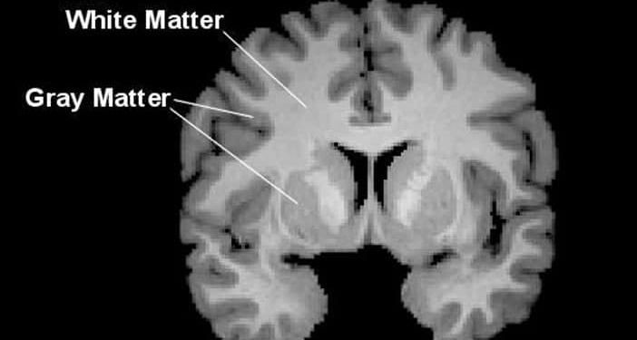 White matter alterations found in brains of college athletes after ...