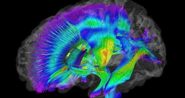 This is an image of white matter pathways extracted from diffusion tensor imaging data for infants at-risk for autism. Warmer colors represent higher fractional anisotropy. (Photo credit: Jason Wolff/UNC)