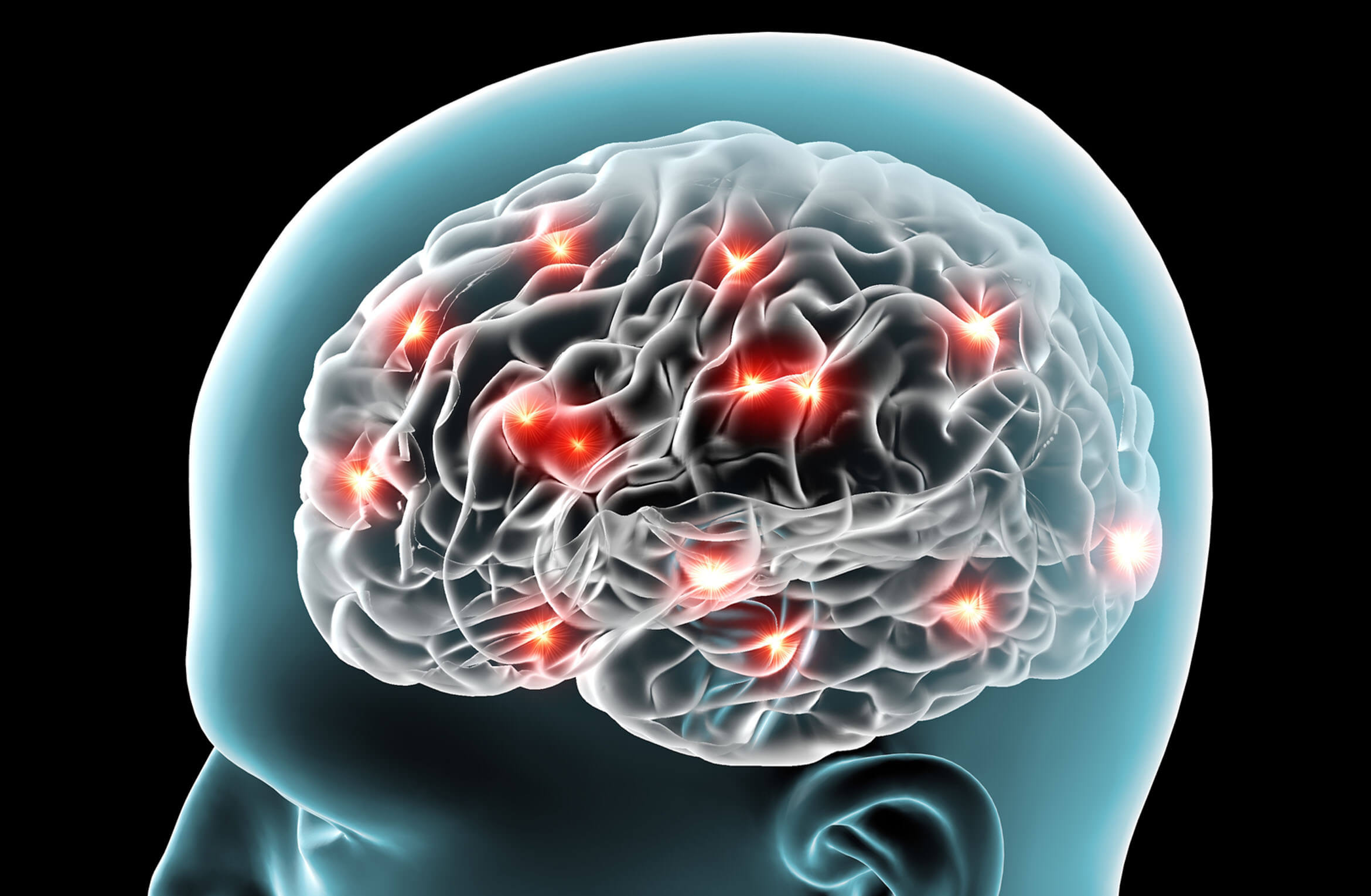 Chronic Pain Linked to Brain Signals in Orbitofrontal Cortex - The