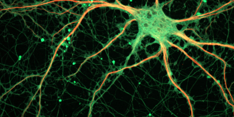 (Photo credit: ZEISS Microscopy)