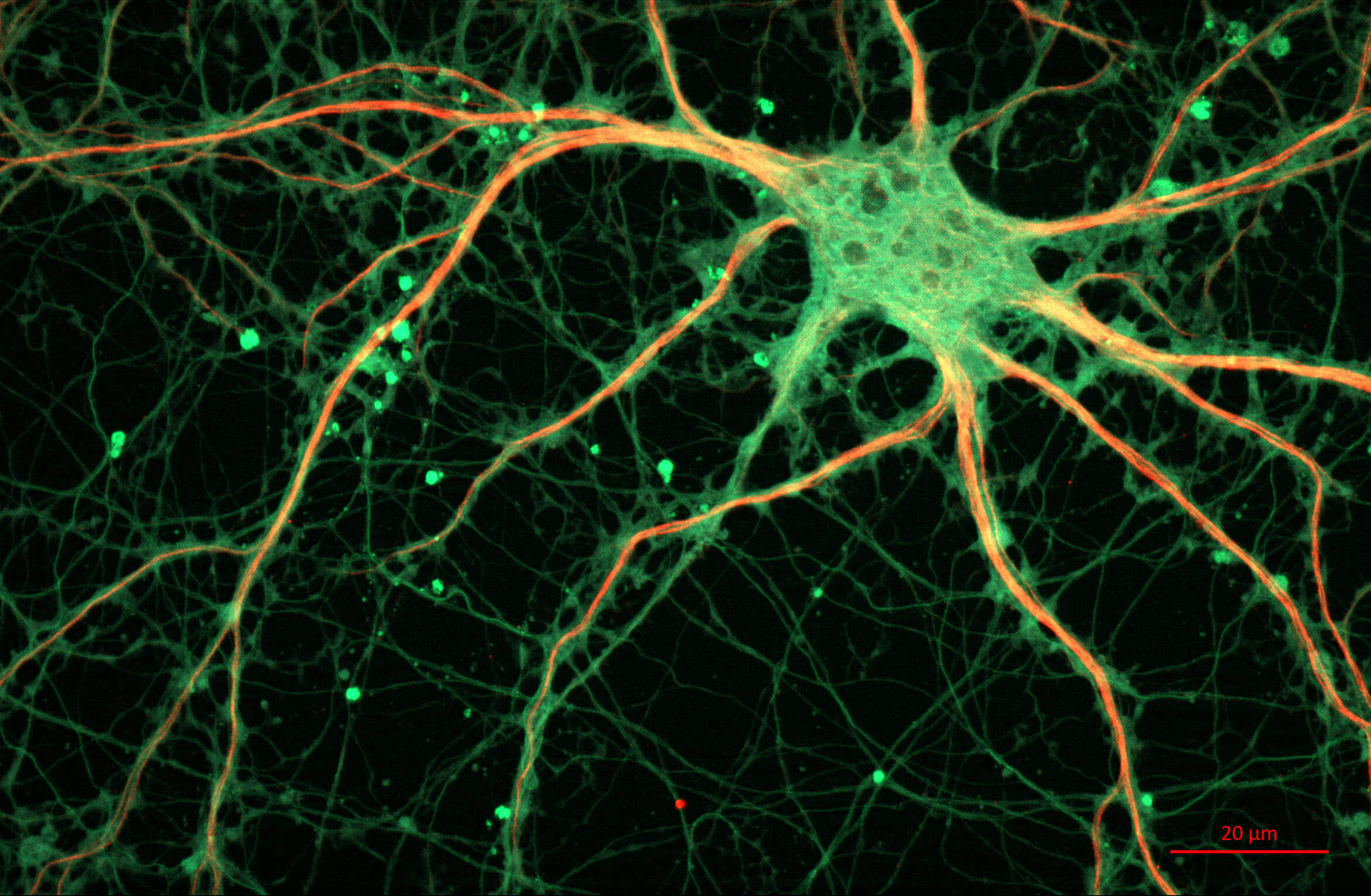 El aislamiento social provoca una disminución de las células cerebrales y un deterioro cognitivo leve