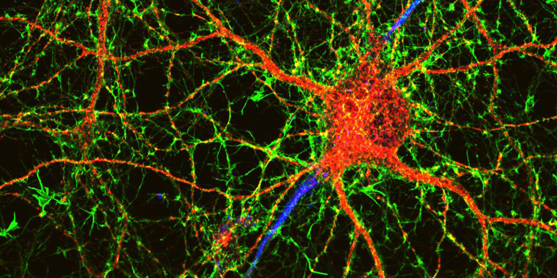 Altered brain pH and lactate levels could play a key role in ...