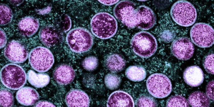 Colorized transmission electron micrograph of monkeypox particles (purple) found within an infected cell (teal), cultured in the laboratory. Image captured and color-enhanced at the NIAID Integrated Research Facility (IRF) in Fort Detrick, Maryland. Credit: NIAID