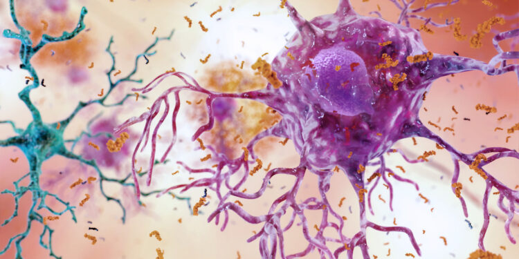 (Photo credit: National Institute on Aging, NIH)