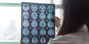 Bright medical professional examining brain MRI scans in a clinical setting for neurological or psychological research.