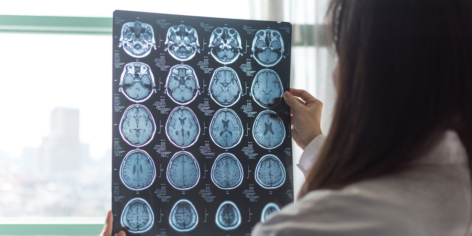 Prenatal exposure to common “forever chemicals” linked to changes in children’s brain structure
