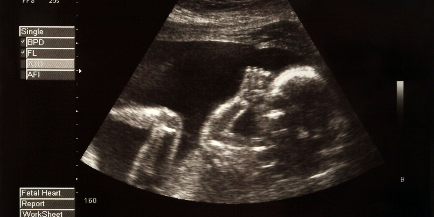 Almost all unmarried pregant women say that the fetus resembles the father, study finds - PsyPost