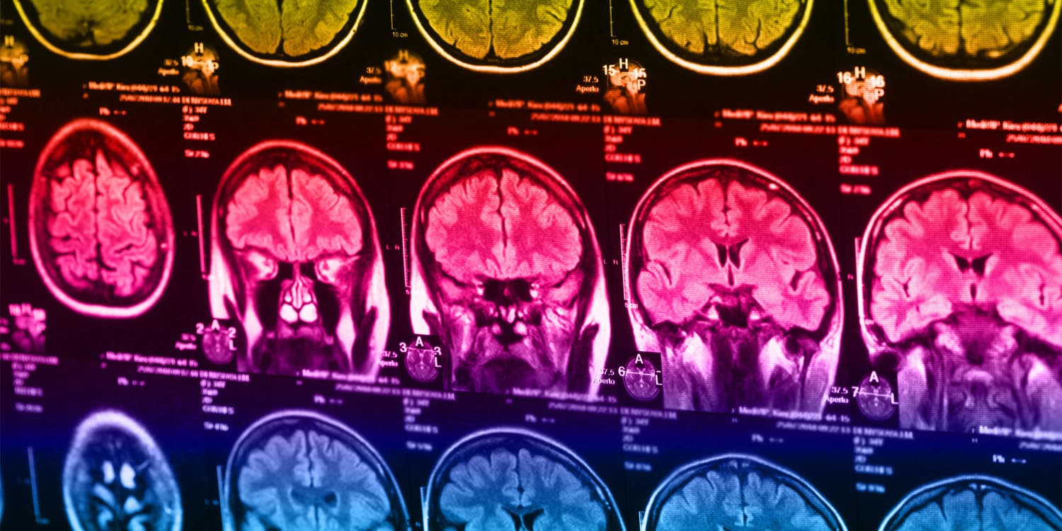 Six distinct biotypes of depression identified by scientists