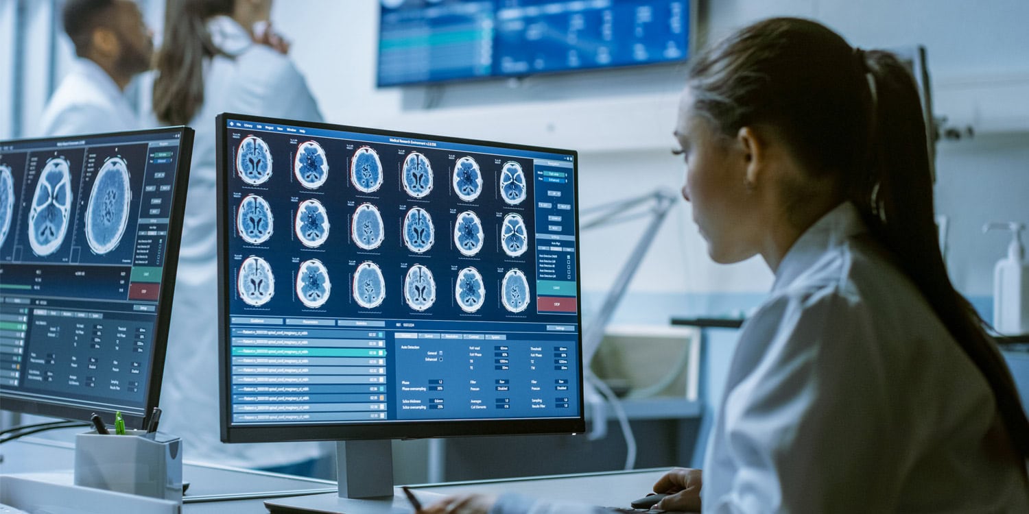 Socioeconomic background tied to distinct brain and behavioral patterns - PsyPost