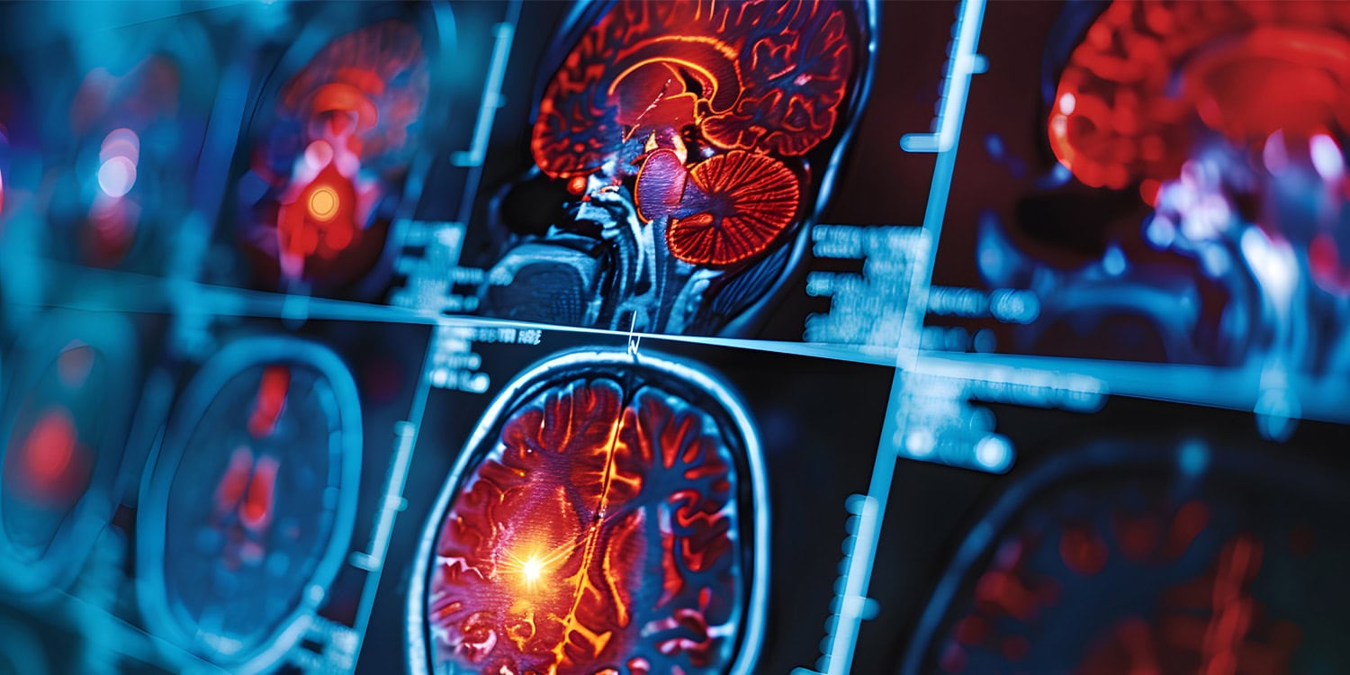 Researchers have created a detailed model of perinatal brain growth, revealing how white and gray matter trajectories shift during gestation. The study also identifies early sex-based differences in brain structure.