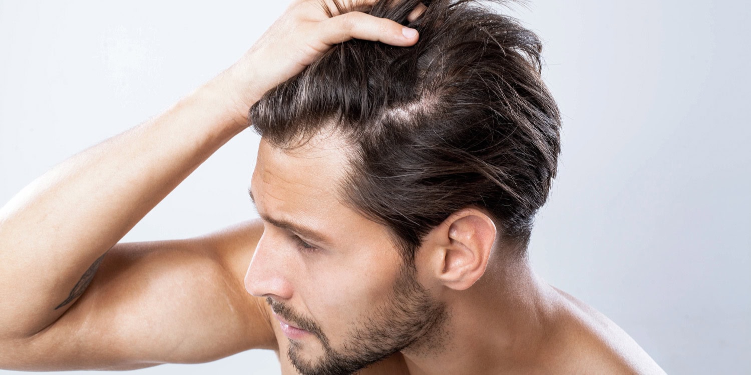 One-time testosterone dose and stress leave lasting hormonal marks in your hair